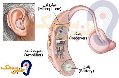 ساختار و ساختمان انواع سمعک چگونه است؟