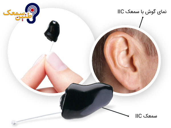 سمعک iic نامرئی استارکی چگونه دیده می‌شود؟