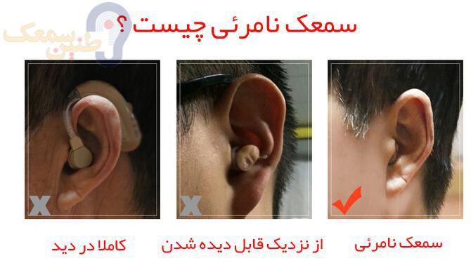 قیمت سمعک نامرئی چقدر است؟