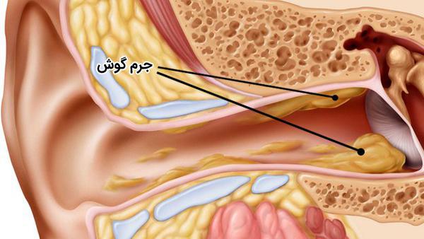 ÙØªÛØ¬Ù ØªØµÙÛØ± Ø¨Ø±Ø§Û Ø¬Ø±Ù Ú¯ÙØ´ ÛØ§ Ø³Ø±ÙÙØ§Ù ÙØ´Ø±Ø¯Ù