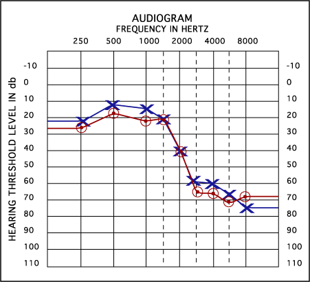 کلینیک شنوایی سنجی تهران