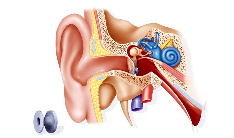 درمان عفونت با گرومت گوش، گرومت گذاری چه کاربردی دارد؟
